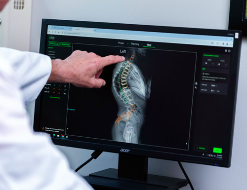 ATEC Launches EOS Insight™, an End-To-End Spine Surgery Platform Powered by EOS Imaging and AI