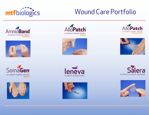 MTF Biologics' wound care portfolio