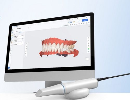 Medit expands its intraoral scanner presence in Slovenia and the Balkans, broadening its market reach in dental technology.