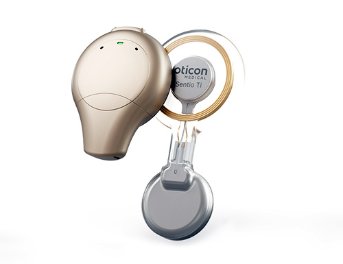 Oticon Medical