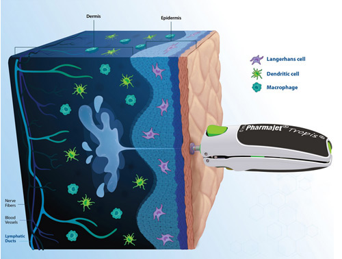 Nature Publication Highlights the Benefits of Tropis® Intradermal 