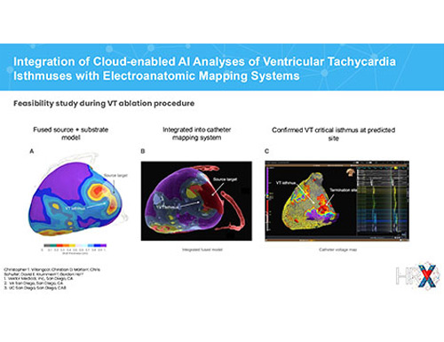 Vektor Medical unveils groundbreaking research on AI and deep learning innovations in ventricular tachycardia analysis